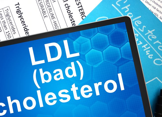 Understanding and Lowering High Cholesterol
